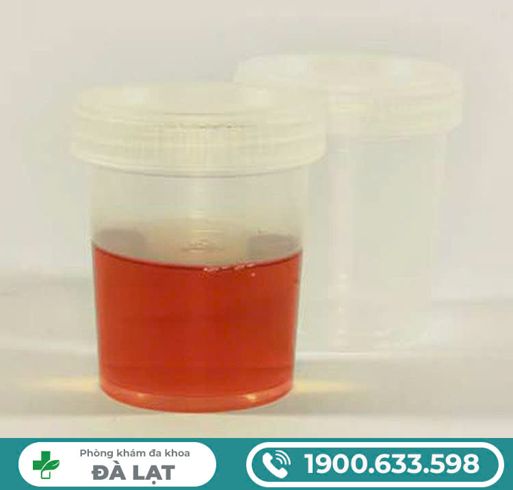 Hình ảnh minh họa